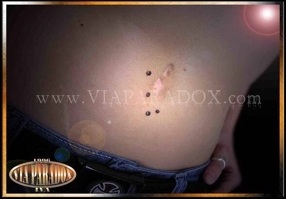 Microdermal - Via Paradox
