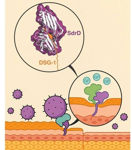 Staphylococcus aureus 