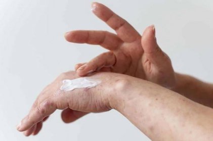 Antifungální tipy pro vaše ruce