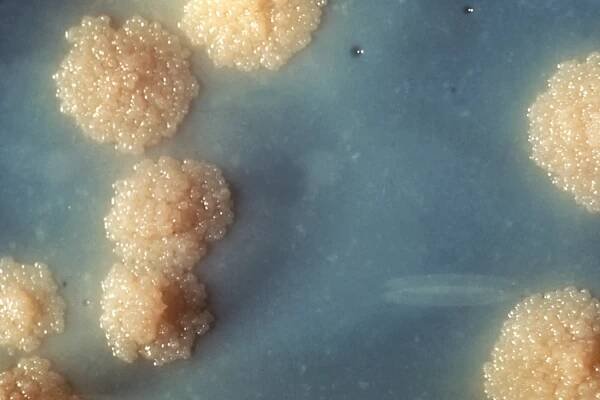 Mycobacterium tuberculosis – WikiSkripta