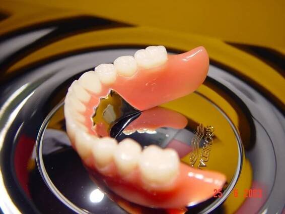 Totální a částečné protézy :: Dentalpraxis.cz