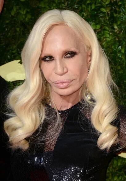 Donatella Versace byla považovaná za královnu plastik.
