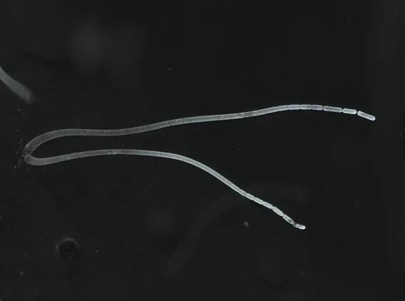 Ever heard of giant bacteria? This new species is way bigger and weirder.