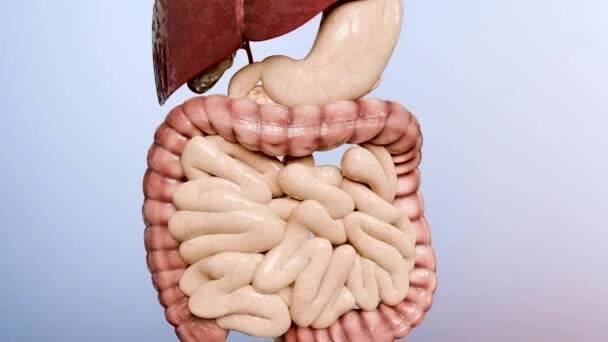 Kolorektální karcinom, zhoubný nádor ve střevě, endoskop uvnitř kolonoskopie, střevní střevo, odstranění tlustého střeva, hledání polypů v tlustém střevě, polypektomie, karcinom střeva, střevní neoplazie, 3d podání — Stock záběr