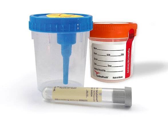 Urine