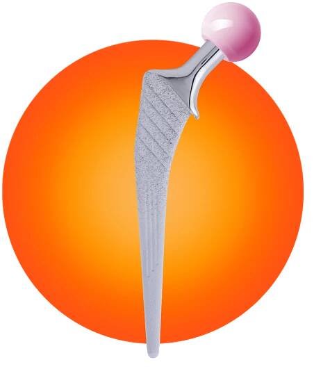 Hip – Biotechni