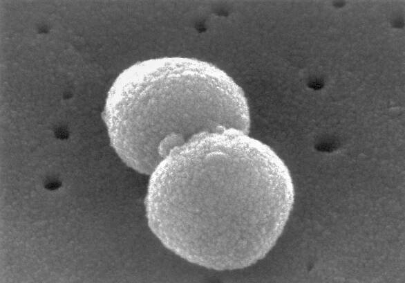 Streptococcus pneumoniae – WikiSkripta