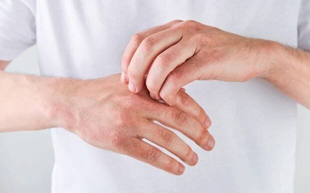Sociální tabu? Atopický ekzém může ovlivňovat duševní zdraví | Epaderm - Mölnlycke