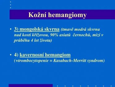 PPT - Novorozenec PowerPoint Presentation, free download - ID:4691361