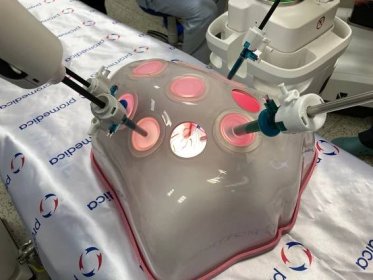 VIDEO: V Brně bude od ledna operovat nový robot, pacientům urychlí zotavení