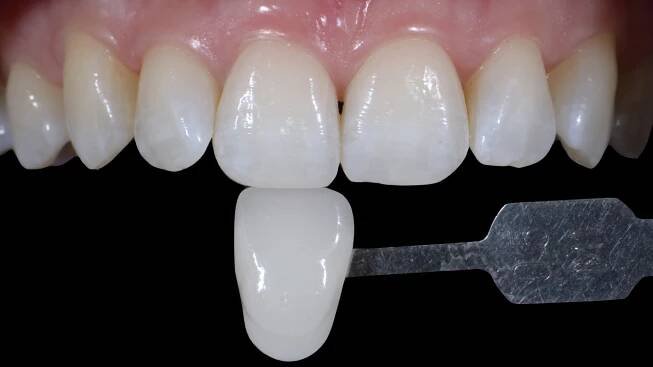 style italiano styleitaliano dentistry