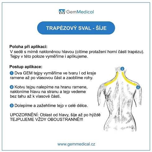 Jak tejpovat namožené trapézy