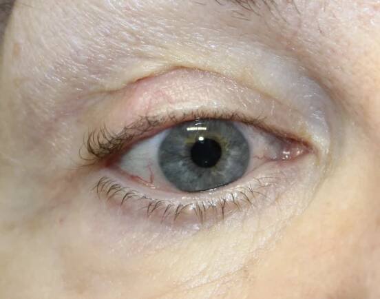 Leon Rafailov, MD - SightMD