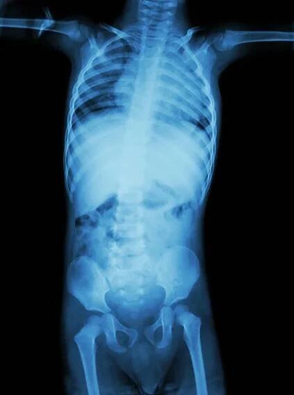 Film X-ray celé tělo dítěte (koncepce medicíny, vědy a zdravotnictví ) — Stock obrázek