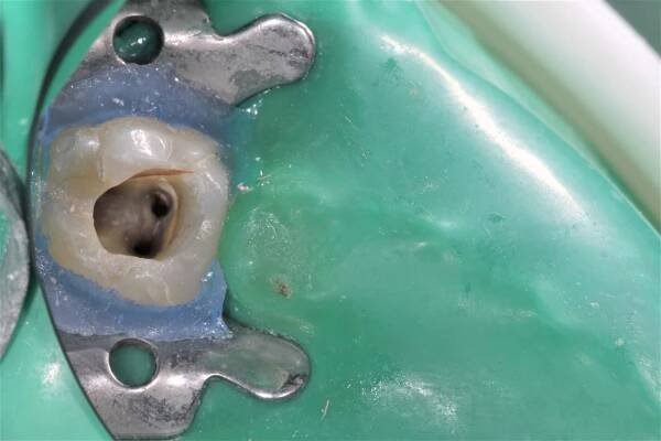 ENDODONCIE - Dentaurum