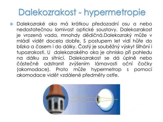 PPT - Oční vady PowerPoint Presentation, free download - ID:6142339