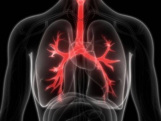 Tracking Down the Origins of Cystic Fibrosis in Ancient Europe
