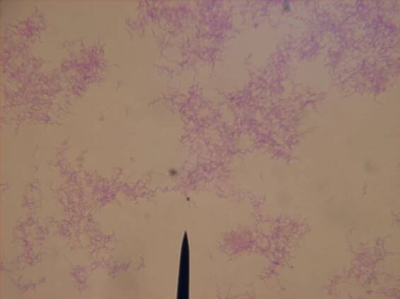 Rhodospirillum rubrum