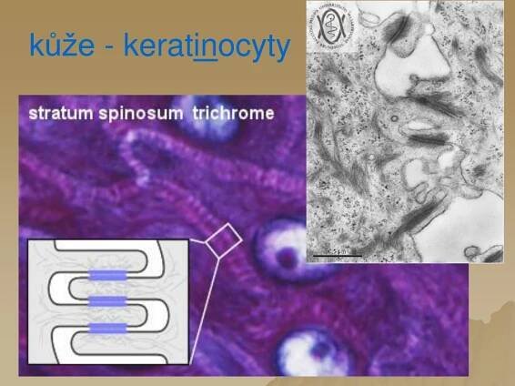 PPT - K ůže a kožní adnex a PowerPoint Presentation, free download - ID:4725739