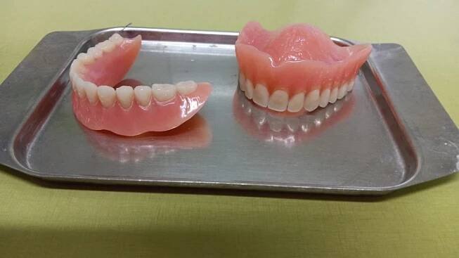 Ženě nabídli zubní implantáty. Z finální částky málem omdlela | PrahaIN 