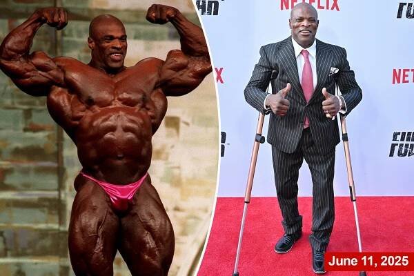 Bodybuilding legend Ronnie Coleman hospitalized with 'serious medical condition'