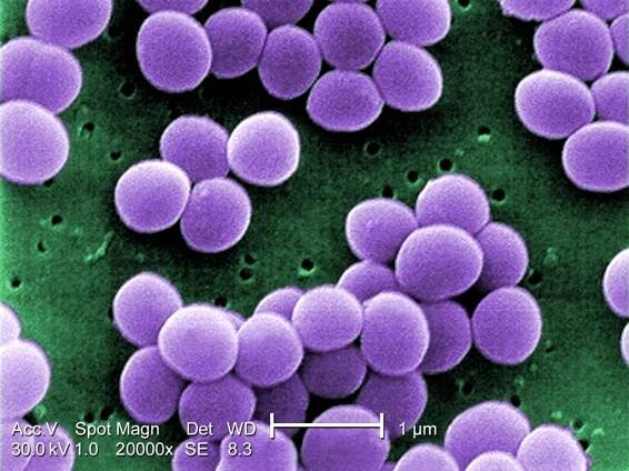 Staphylococcus aureus, zlatý stafylokok, 20,000x zvětšeno pod... | iROZHLAS - spolehlivé zprávy