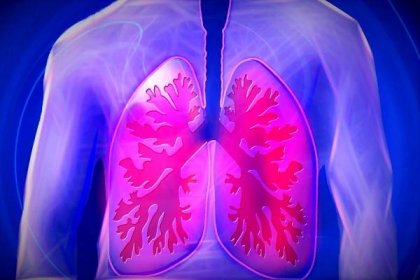 Lékaři mohou díky „screeningu“ zachytit stovky nádorů plic