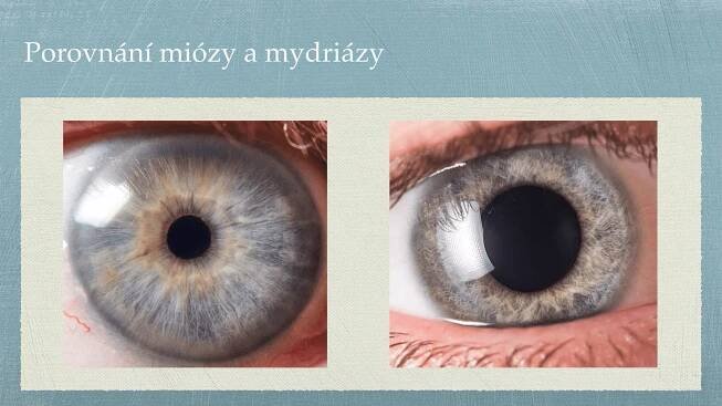 Irisdiagnostika – online video kurz | Taomi