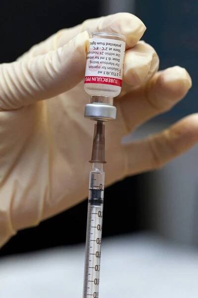 Vědci představili nové očkování proti tuberkulóze. Má šanci změnit svět, míní