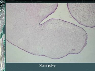Patologie dýchacího systému a pleury Z. Kolář - PDF Stažení zdarma