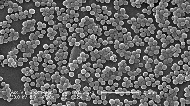 Infections caused by Staphylococcus Aureus - Dental Pockets Blog