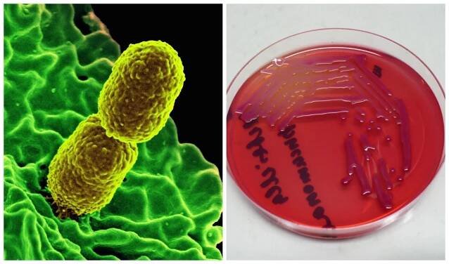 V polské nemocnici našli vzácnou bakterii. Je odolná vůči antibiotikům