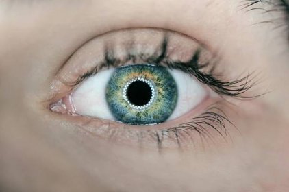 Nepovedená operace očních víček: 5 běžných komplikací a rady jak jim předejít