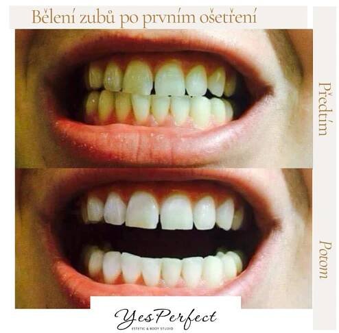 Before and After Instagram Post(1)