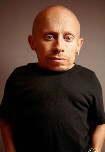 Austin Powers Star Verne Troyer's Cause of Death Ruled a Suicide from Alcohol Intoxication