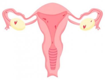 rodidla. endometrióza, vektorová ilustrace - genitální bradavice stock ilustrace