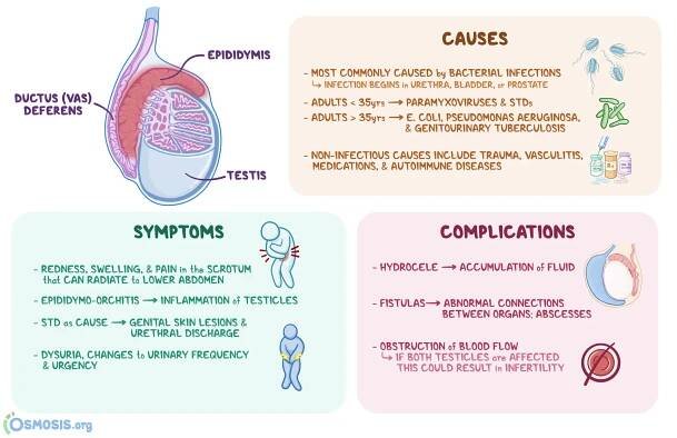 An infographic detailing the causes, signs and symptoms, diagnosis, and treatment of Epididymitis