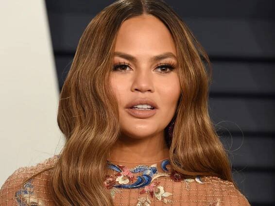 Chrissy Teigen Explained Why She Is Getting Botox While Pregnant