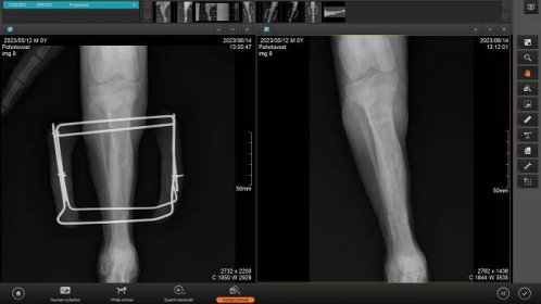 Zlomenina holenní kostí u psa - externí fixátor - VetVill - veterinární klinika Svitavy