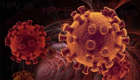 Lidský papilomavirus s vysokým onkogenním rizikem