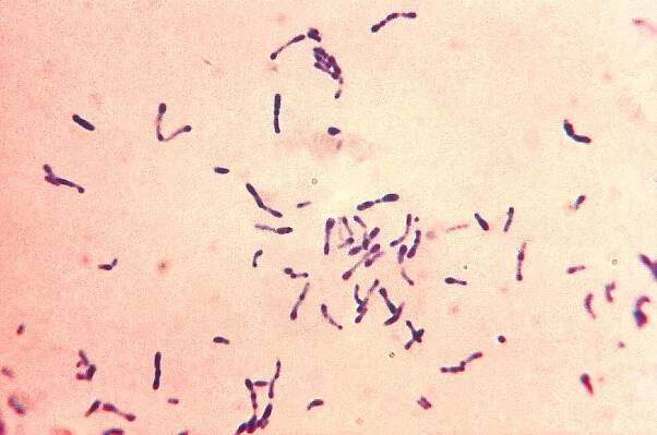 Corynebacterium diphtheriae – Wikipedia