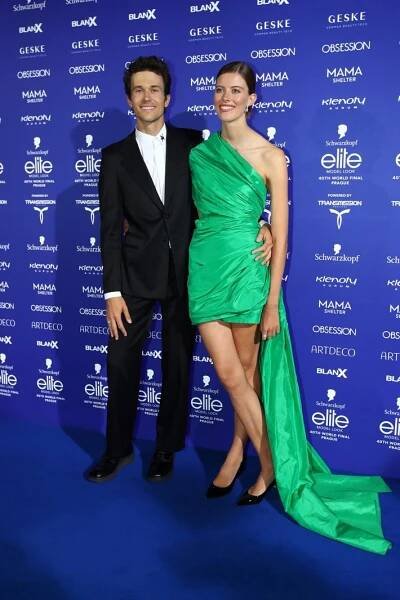Modelka Podzimková, žena Alberta Černého: Nesnášela sama sebe! Kvůli akné