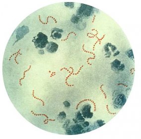 Streptokok (Streptococcus) je rod kokovitých grampozitivních ba... - dofaq.co