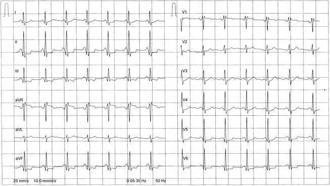 Téma: Intervenční kardiologie – Diagnostika a léčba ICHS v intervenční kardiologiii (8 případů) « Tvorba a ověření e-learningového