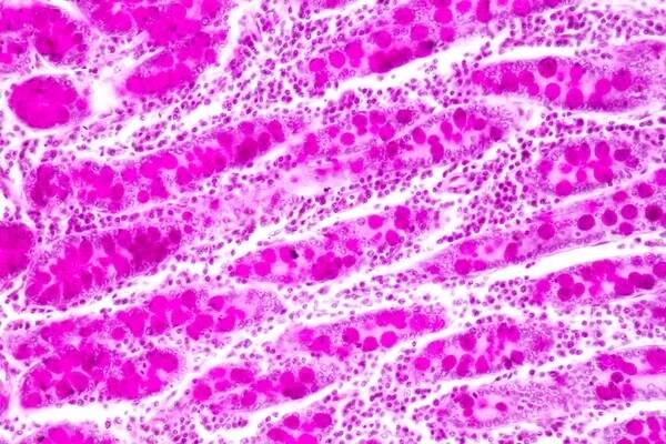 Tkáň tenkého střeva (duodenum) a Vermiform appendix Human pod mikroskopem v laboratoři. — Stock obrázek