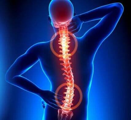 místa osteochondrózy páteře