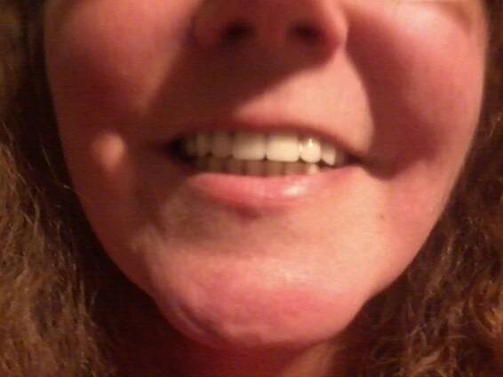 This is me smiling while wearing my false teeth.