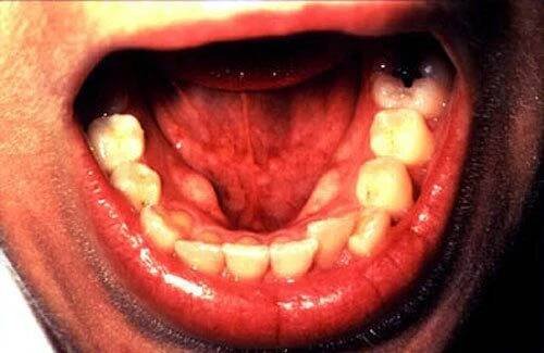 spit, saliva, saliva produced daily
