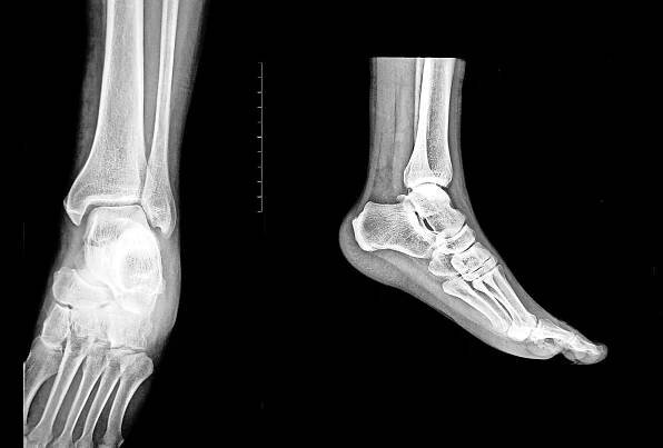 Arthroskopie kann helfen - Zofinger Tagblatt