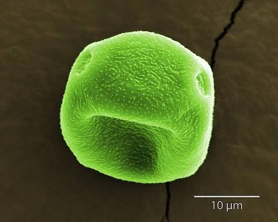 File:LUT SEM Alder pollen 3kx.jpg - Wikimedia Commons